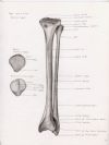 right tibia and fibula posterior aspect