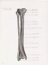 right tibia and fibula anterior aspect