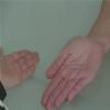 Hand & Wrist Examination - Thumb Movements