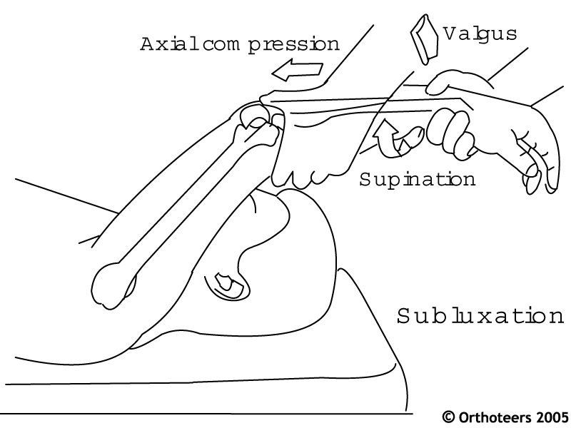 Elbow Exam
