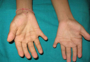 external image ellis2.jpg