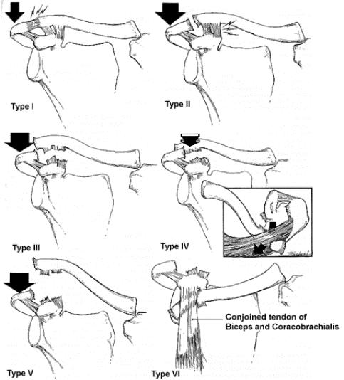 Classification
